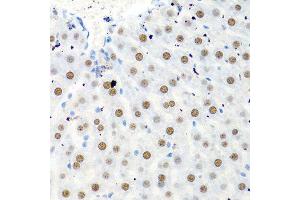 Immunohistochemistry of paraffin-embedded rat liver using PTBP1 antibody. (PTBP1 anticorps  (AA 1-100))