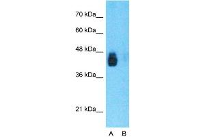 Host:  Rabbit  Target Name:  CD36  Sample Type:  Human Fetal Liver  Lane A:  Primary Antibody  Lane B:  Primary Antibody + Blocking Peptide  Primary Antibody Concentration:  1ug/ml  Peptide Concentration:  5ug/ml  Lysate Quantity:  25ug/lane/lane  Gel Concentration:  0.