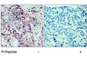 Image no. 1 for anti-Mitogen-Activated Protein Kinase Kinase 4 (MAP2K4) (pSer80) antibody (ABIN196910) (MAP2K4 anticorps  (pSer80))