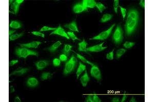Immunofluorescence of monoclonal antibody to KIFC1 on HeLa cell.