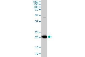 TPT1 monoclonal antibody (M01), clone 3C7 Western Blot analysis of TPT1 expression in HepG2 .