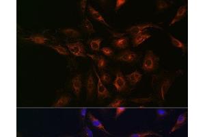 Immunofluorescence analysis of C6 cells using ABCA1 Polyclonal Antibody at dilution of 1:100 (40x lens). (ABCA1 anticorps)