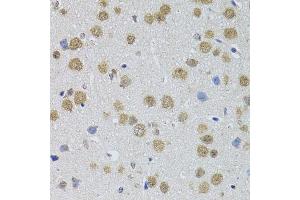 Immunohistochemistry of paraffin-embedded mouse brain using DMAP1 antibody.