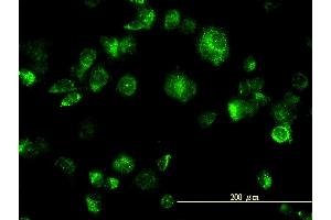 Immunofluorescence of monoclonal antibody to MAPK12 on HeLa cell. (MAPK12 anticorps  (AA 251-367))