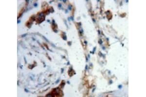 Used in DAB staining on fromalin fixed paraffin-embedded Lung tissue (LTBP2 anticorps  (AA 522-814))