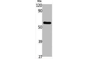 Western Blot analysis of various cells using GCK Polyclonal Antibody