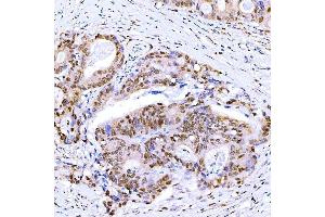 IHC analysis of Symplekin/SYMPK using anti-Symplekin/SYMPK antibody (ABIN7601558). (Symplekin anticorps  (AA 384-1092))