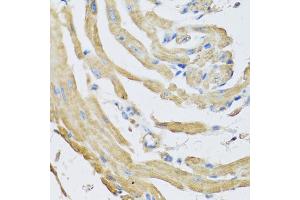Immunohistochemistry of paraffin-embedded mouse heart using SFRP4 antibody (ABIN5973810) at dilution of 1/100 (40x lens). (SFRP4 anticorps)