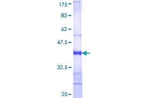 Neutral alpha-Glucosidase (AA 2272-2371) protein (GST tag)