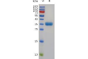 Human TP Protein, His Tag on SDS-PAGE under reducing condition.