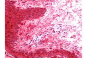 Anti-LGALS7 / Galectin 7 antibody IHC staining of human skin. (LGALS7 anticorps  (Biotin))