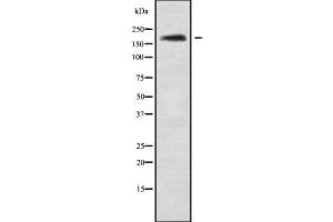 Western blot analysis NRXN3 using Jurkat whole cell lysates (Neurexin 3 anticorps  (Internal Region))