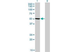 Western Blot analysis of PHGDH expression in transfected 293T cell line by PHGDH monoclonal antibody (M01), clone 4A3-1D6.