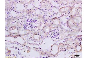 Formalin-fixed and paraffin embedded mouse colon tissue labeled with Anti-TNFSF18 Polyclonal Antibody, Unconjugated (ABIN740535) at 1:200 followed by conjugation to the secondary antibody and DAB staining