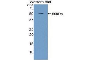 Western Blotting (WB) image for anti-Furin (Paired Basic Amino Acid Cleaving Enzyme) (FURIN) (AA 587-748) antibody (ABIN1858928) (FURIN anticorps  (AA 587-748))