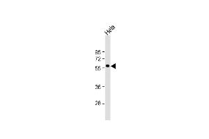 Anti-MKNK2 Antibody (C-term) at 1:1000 dilution + Hela whole cell lysate Lysates/proteins at 20 μg per lane.