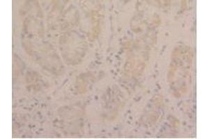 Detection of STAT3 in Human Stomach Tissue using Polyclonal Antibody to Signal Transducer And Activator Of Transcription 3 (STAT3)