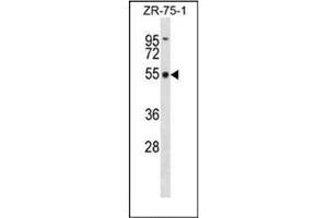 Western blot analysis of FBXO5 Antibody (Center) in ZR-75-1 cell line lysates (35ug/lane). (FBXO5 anticorps  (Middle Region))