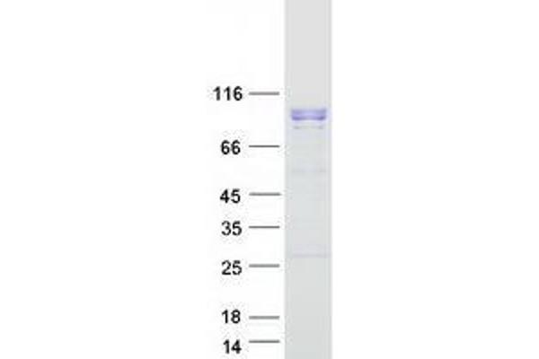 WDR36 Protein (Myc-DYKDDDDK Tag)