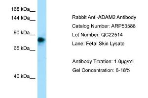 Western Blotting (WB) image for anti-ADAM Metallopeptidase Domain 2 (ADAM2) (N-Term) antibody (ABIN2785462) (ADAM2 anticorps  (N-Term))