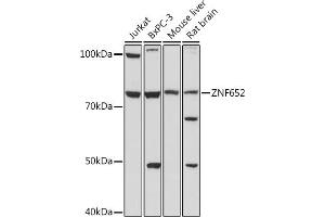 Western blot analysis of extracts of various cell lines, using ZNF652 antibody (ABIN7271517) at 1:1000 dilution. (ZNF652 anticorps)