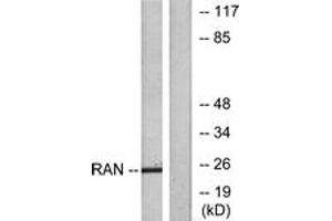 Western blot analysis of extracts from LOVO cells, using RAN Antibody. (RAN anticorps  (AA 167-216))
