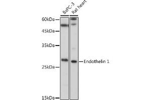 Western blot analysis of extracts of various cell lines, using Endothelin 1 antibody (ABIN3021075, ABIN3021076, ABIN3021077 and ABIN6213940) at 1:1000 dilution. (Endothelin 1 anticorps  (AA 18-212))