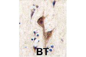 Formalin-fixed and paraffin-embedded human brain tissue reacted with HRH3 polyclonal antibody  , which was peroxidase-conjugated to the secondary antibody, followed by DAB staining. (HRH3 anticorps  (C-Term))