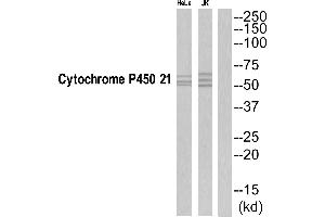 Western blot analysis of extracts from Jurkat/HeLa cells, using CYP21A2 antibody. (CYP21A2 anticorps  (C-Term))