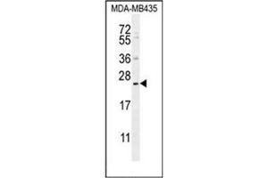 Western blot analysis of FAM109A Antibody (N-term) in MDA-MB435 cell line lysates (35ug/lane). (FAM109A anticorps  (N-Term))