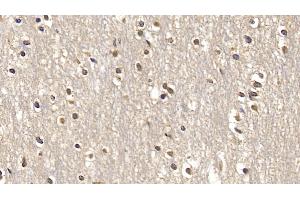 Detection of SMAD3 in Human Cerebrum Tissue using Monoclonal Antibody to SMAD family member 3 (SMAD3)