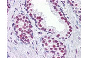 Anti-RUNX2 antibody IHC of human prostate. (RUNX2 anticorps  (AA 251-351))