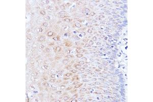 Immunohistochemistry of paraffin-embedded human esophageal using P antibody (ABIN7269446) at dilution of 1:100 (40x lens).