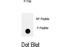 Dot Blot (DB) image for anti-Insulin Receptor Substrate 2 (IRS2) (pTyr978) antibody (ABIN3001883) (IRS2 anticorps  (pTyr978))