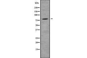 Western blot analysis IL31R using HepG2 whole cell lysates (IL31RA anticorps  (Internal Region))