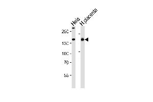 Western blot analysis of lysates from Hela cell line and human placenta tissue lysate(from left to right), using COL4A1 Antibody (N-term) A.