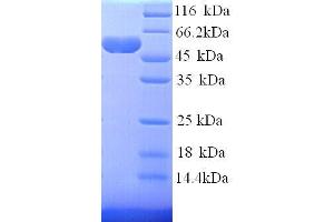 Hexokinase 1 (HK1) (AA 1-485) protein (His tag) (Hexokinase 1 Protein (HK1) (AA 1-485) (His tag))