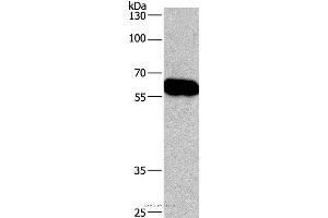 Western blot analysis of Lovo cell , using CORO1C Polyclonal Antibody at dilution of 1:670 (CORO1C anticorps)