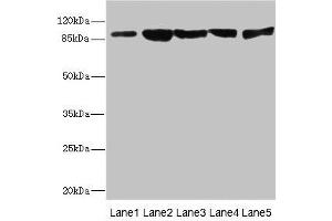 Western blot All lanes: DSC2 antibody at 3. (Desmocollin 2 anticorps  (AA 520-690))