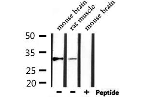 Western blot analysis of extracts from rat muscle, mouse brain, using MARCH1 Antibody. (MARCH1 anticorps  (C-Term))