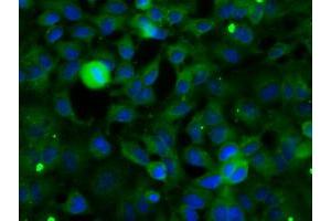 Image no. 3 for anti-Sorting Nexin 9 (SNX9) antibody (ABIN1501044)