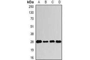 Western blot analysis of VENTX expression in A549 (A), HepG2 (B), mouse spinal cord (C), rat bone marrow (D) whole cell lysates.