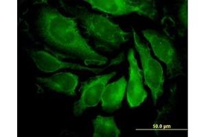 Image no. 4 for anti-P21-Activated Kinase 1 (PAK1) (AA 191-280) antibody (ABIN598852) (PAK1 anticorps  (AA 191-280))