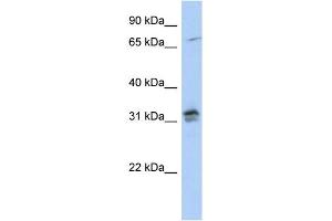 WB Suggested Anti-H1FOO Antibody Titration: 0. (H1FOO anticorps  (N-Term))