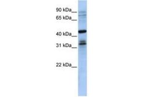 Image no. 1 for anti-Musashi Homolog 2 (MSI2) (N-Term) antibody (ABIN6740711) (MSI2 anticorps  (N-Term))