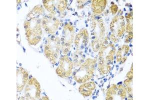 Immunohistochemistry of paraffin-embedded Human stomach using BNIP3L Polyclonal Antibody at dilution of 1:100 (40x lens).