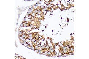 Immunohistochemistry of paraffin-embedded rat testis using Nectin 2/CD112 Rabbit mAb (ABIN7269432) at dilution of 1:100 (40x lens). (PVRL2 anticorps)