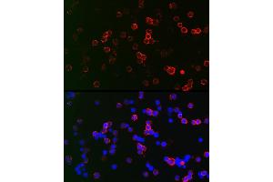 Immunofluorescence analysis of Raji cells using CD22 Rabbit pAb (ABIN6131253, ABIN6138143, ABIN6138144 and ABIN6221471) at dilution of 1:150 (40x lens).