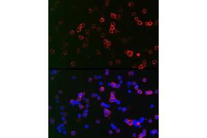 Immunofluorescence analysis of Raji cells using CD22 Rabbit pAb (ABIN6131253, ABIN6138143, ABIN6138144 and ABIN6221471) at dilution of 1:150 (40x lens). (CD22 anticorps  (AA 708-847))
