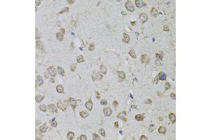 Immunohistochemistry of paraffin-embedded mouse brain using TRPC3 antibody (ABIN5995383) (40x lens). (TRPC3 anticorps)